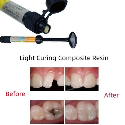 New Dental Cement Cavity Filling Strong Teeth Tooth Repair Restoration Filling