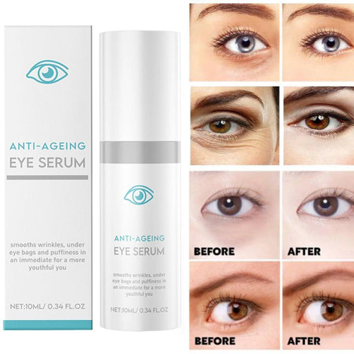 My Perfect Eyes Anti-ageing Eye Serum Lines Reduces Wrinkles for Dark Circles