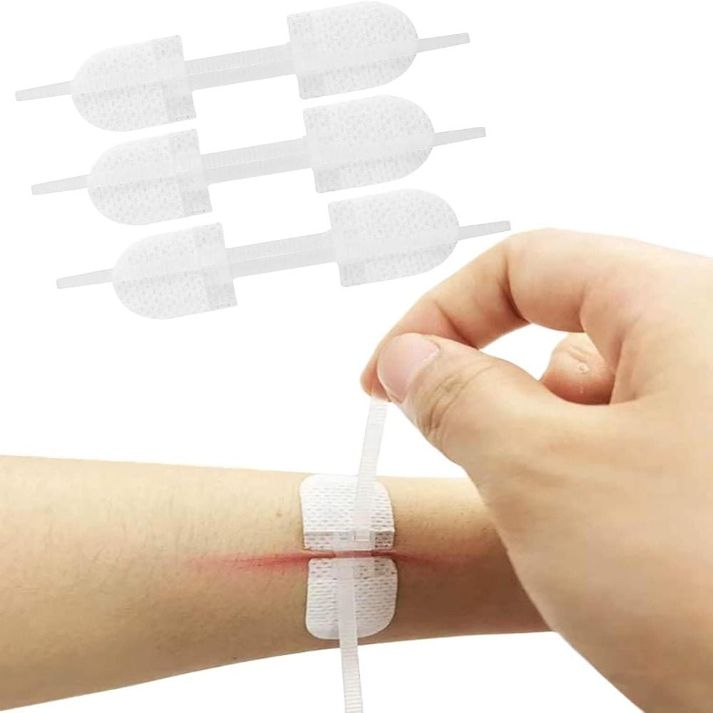 Zipper Tie Wound Closure Patch Hemostatic Patch Wound Fast Suture Zipper Band