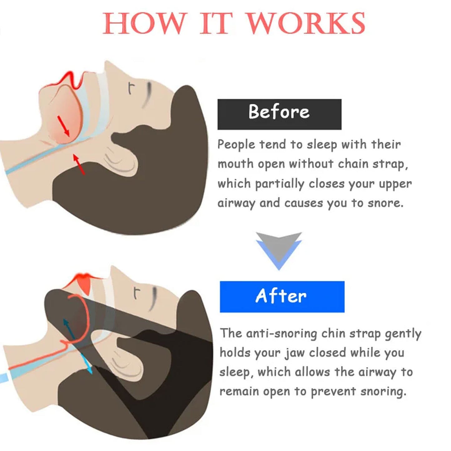 Oraclose Jaw Strap, Ora Close Jaw Strap, Oraclose Jaw Strap for Snoring, for men