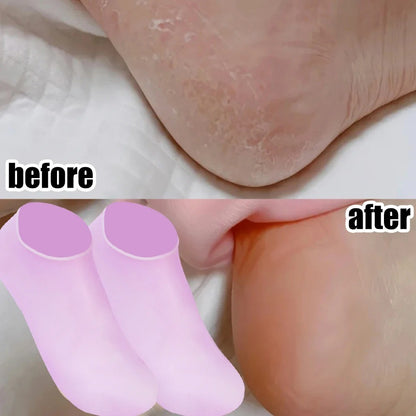 Spa Massage Silicone Moisturizing Foot Socks Breathable Foot Socks  Foot Spa